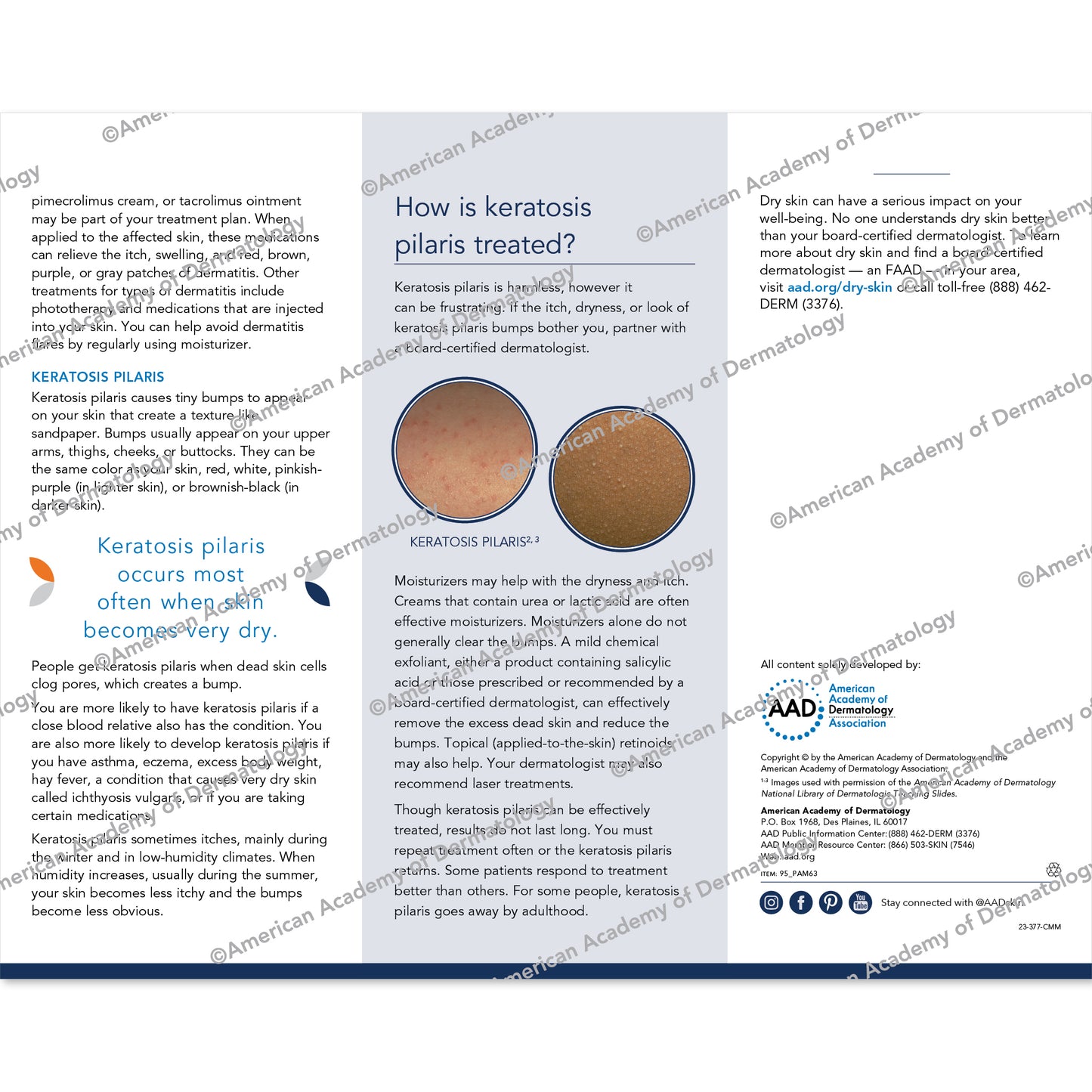 Dry Skin and Keratosis Pilaris Pamphlet