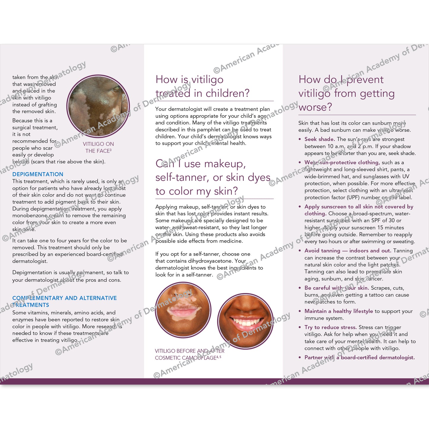 Vitiligo Pamphlet