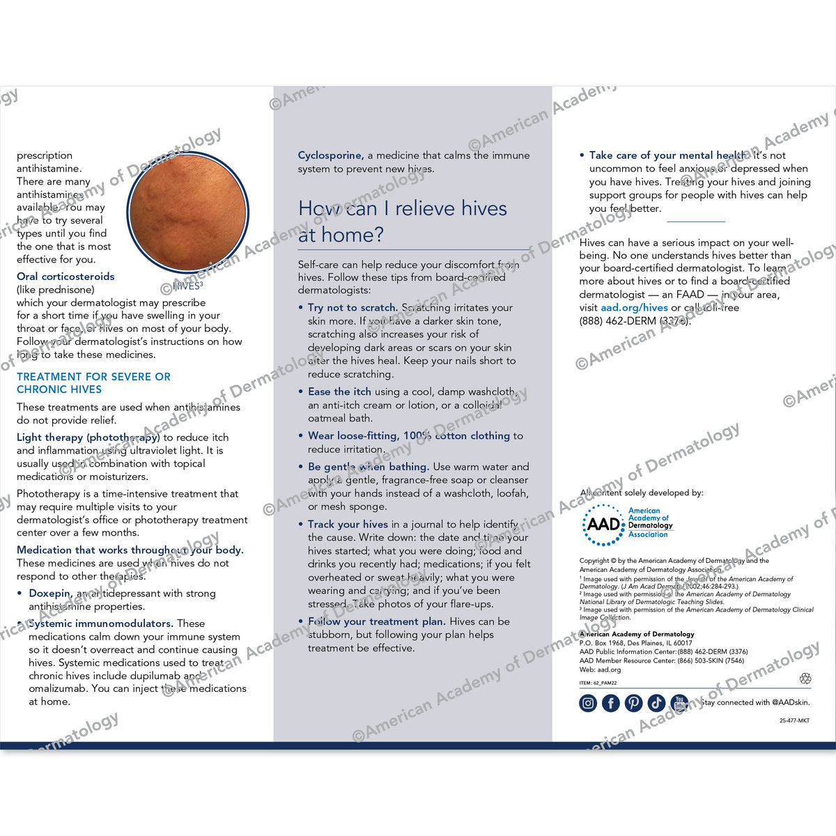HIVES & CHRONIC SPONTANEOUS URTICARIA Pamphlet by the AAD 
