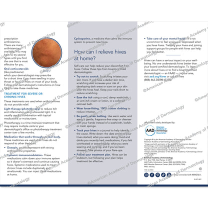 HIVES & CHRONIC SPONTANEOUS URTICARIA Pamphlet by the AAD 