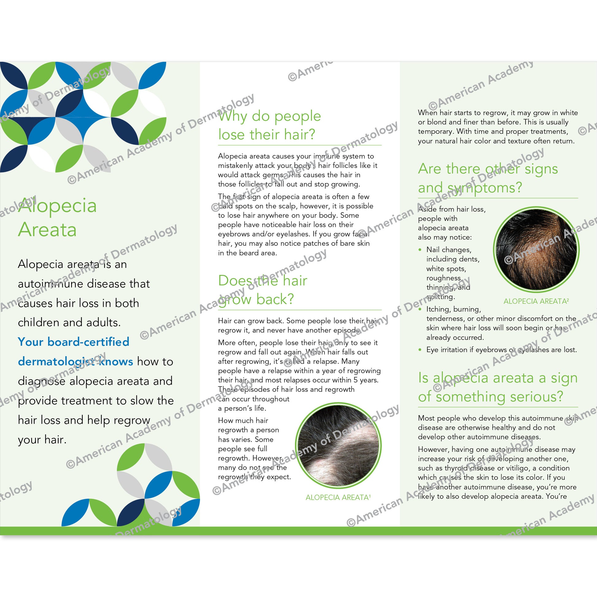 Alopecia Areata Pamphlet