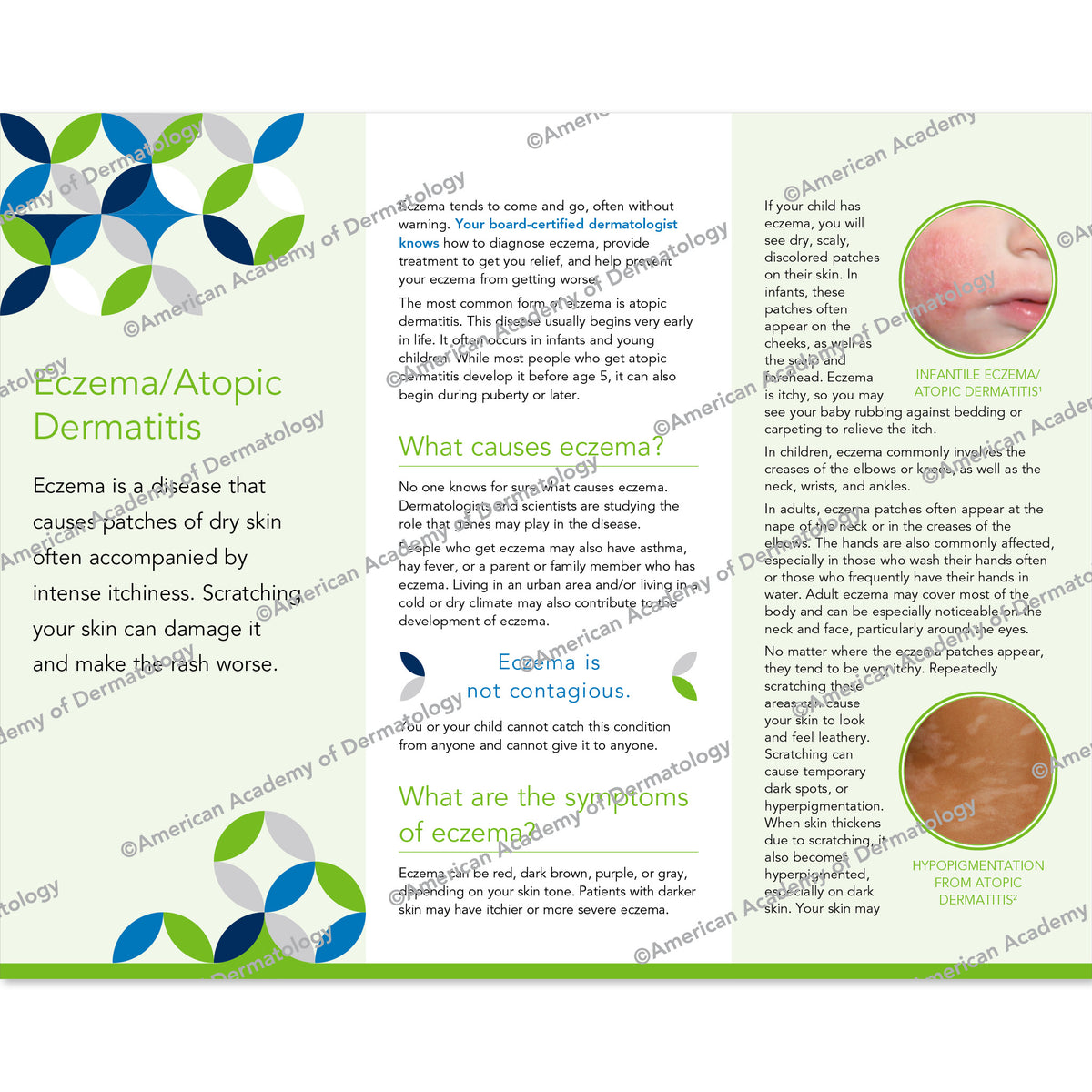 Eczema / Atopic Dermatitis Pamphlet