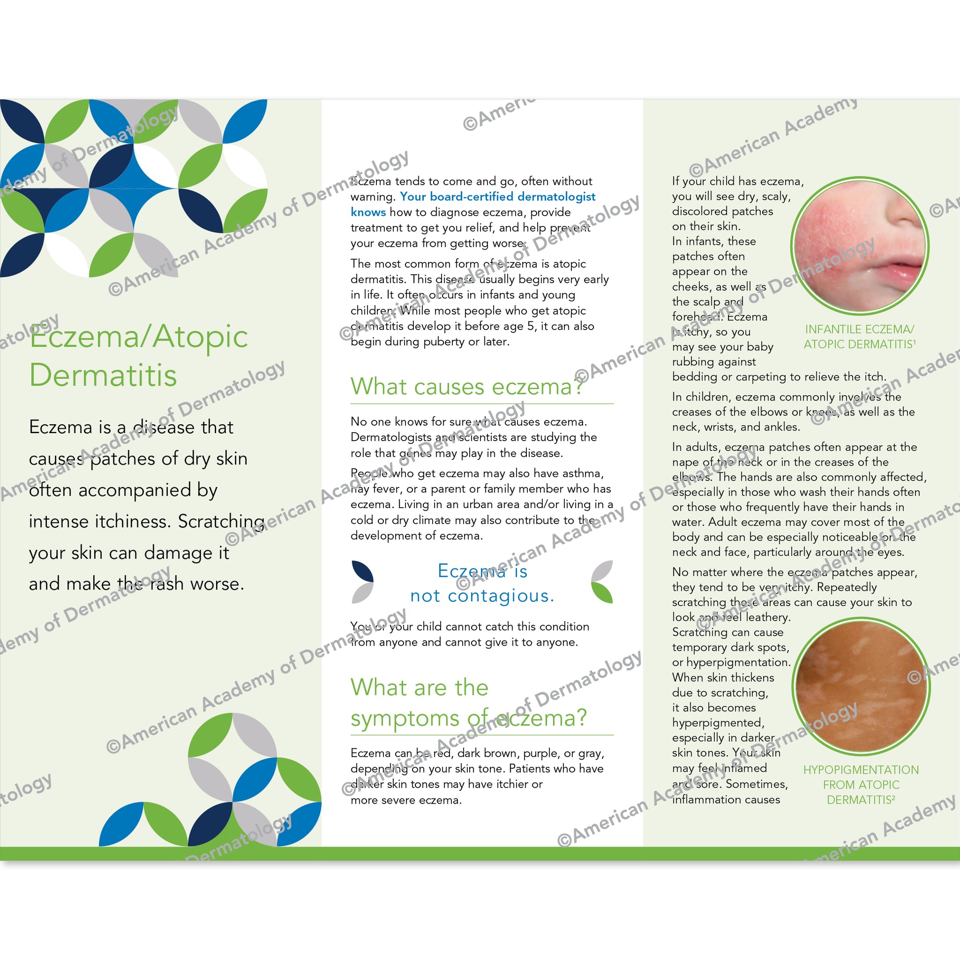 Eczema / Atopic Dermatitis Pamphlet