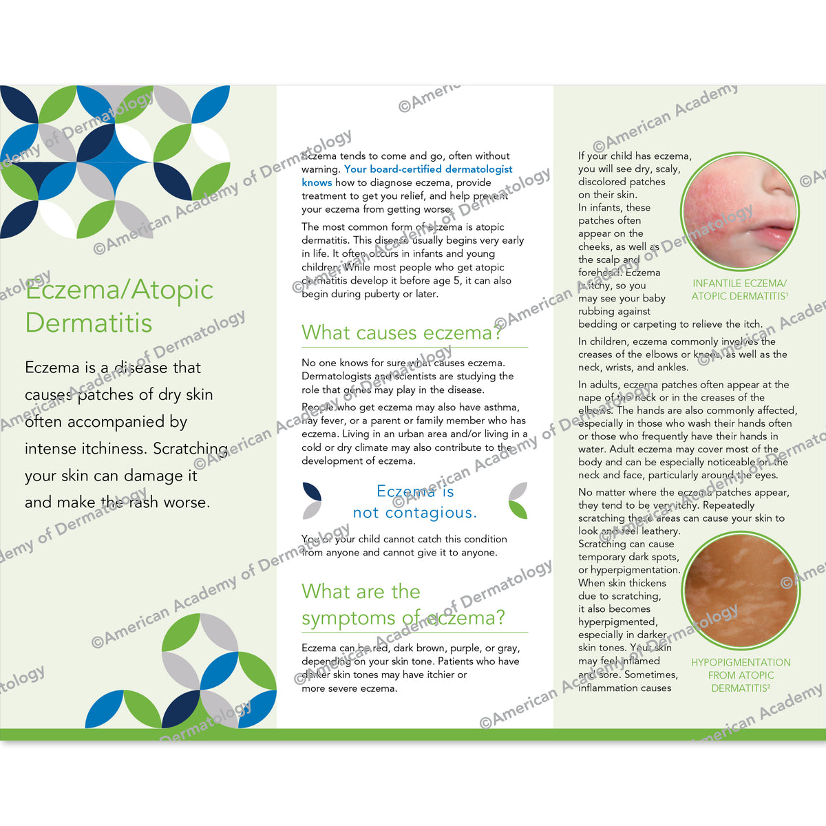 Eczema / Atopic Dermatitis Pamphlet