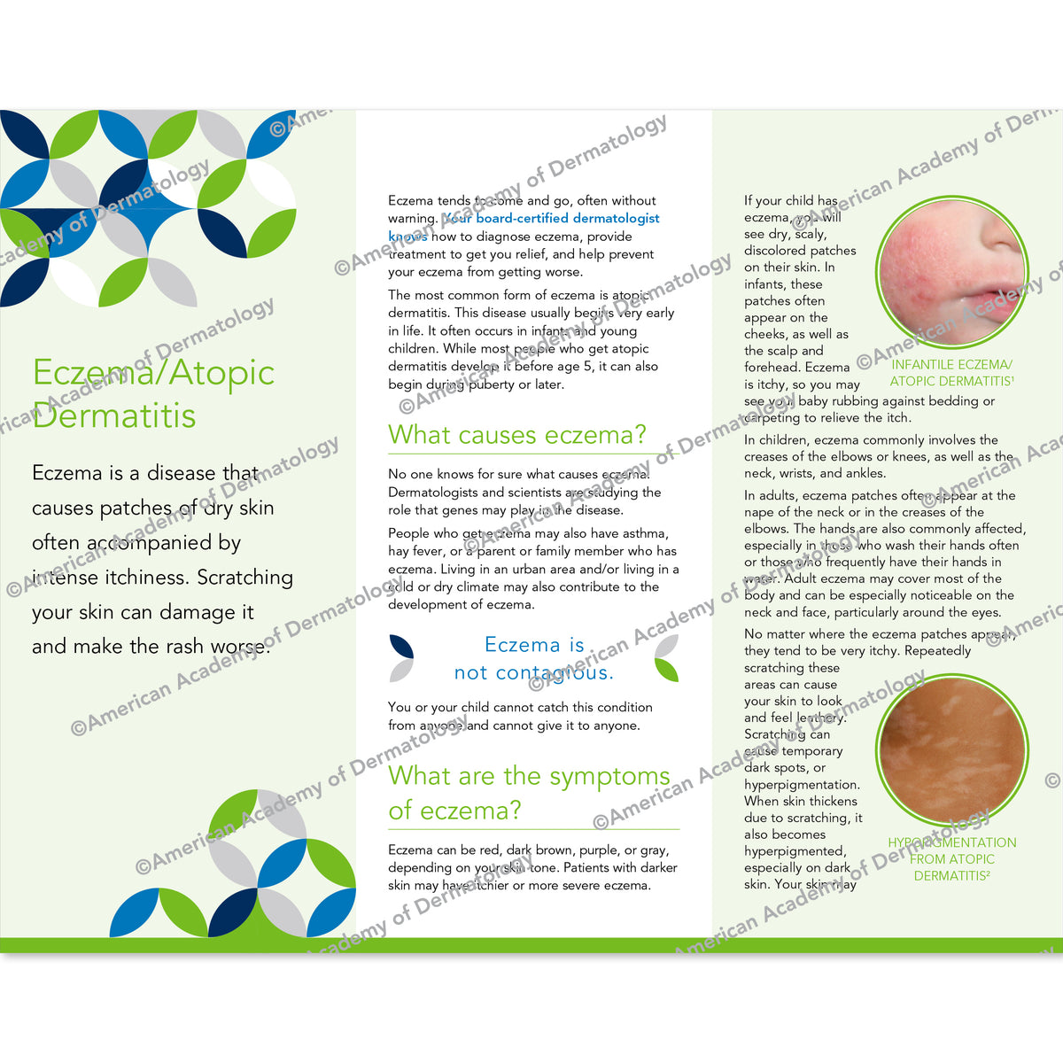 Eczema / Atopic Dermatitis Pamphlet