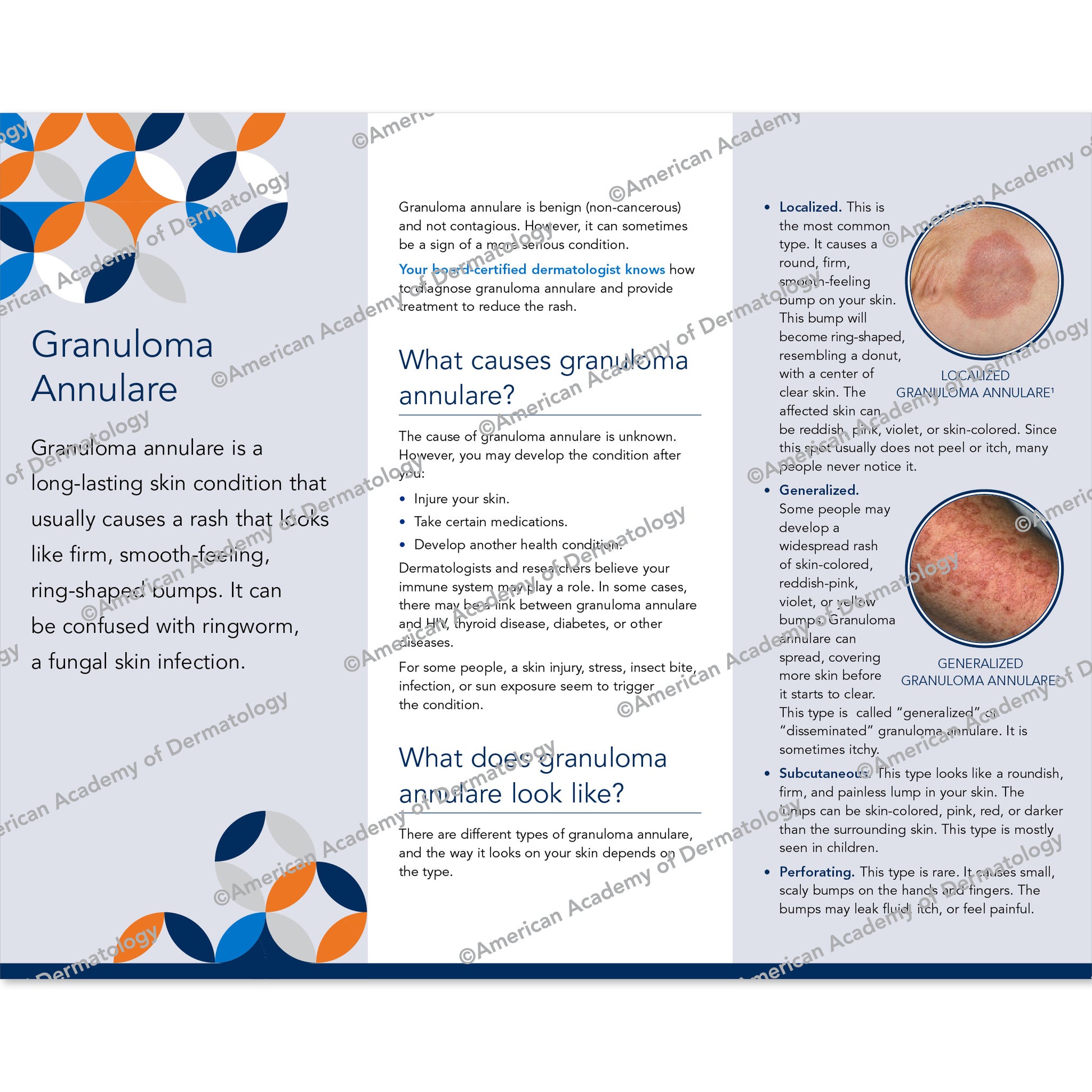Granuloma Annulare Pamphlet