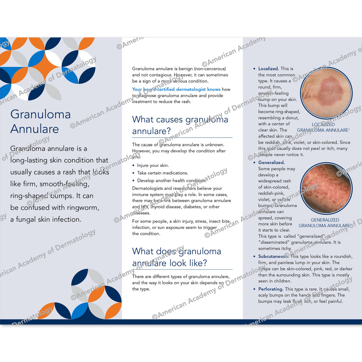 Granuloma Annulare Pamphlet