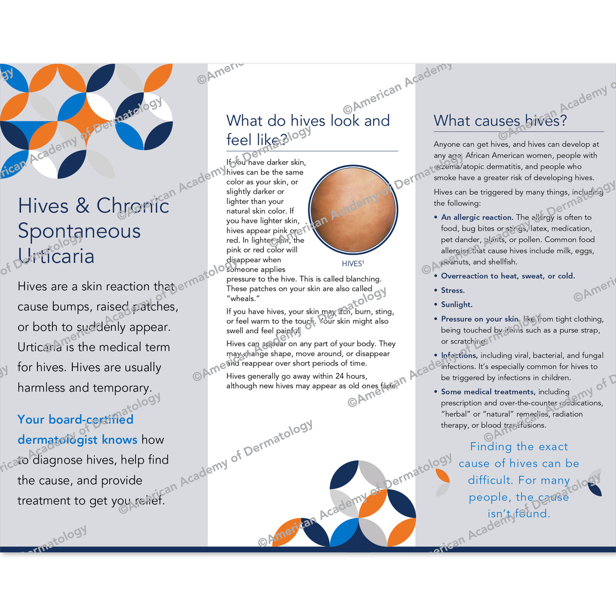 HIVES & CHRONIC SPONTANEOUS URTICARIA Pamphlet by the AAD 