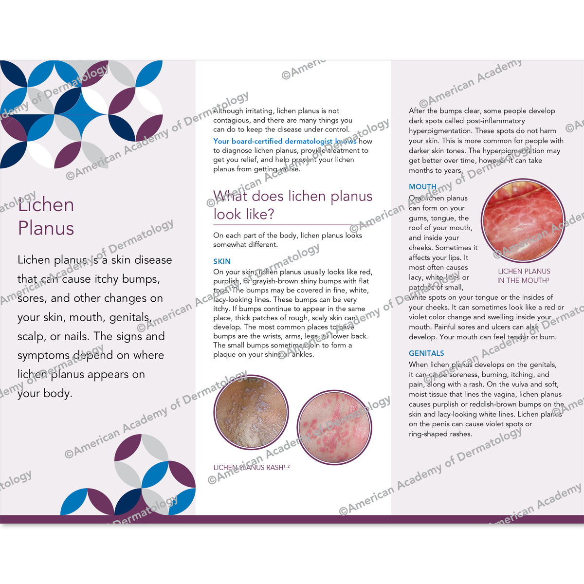 Lichen Planus Pamphlet