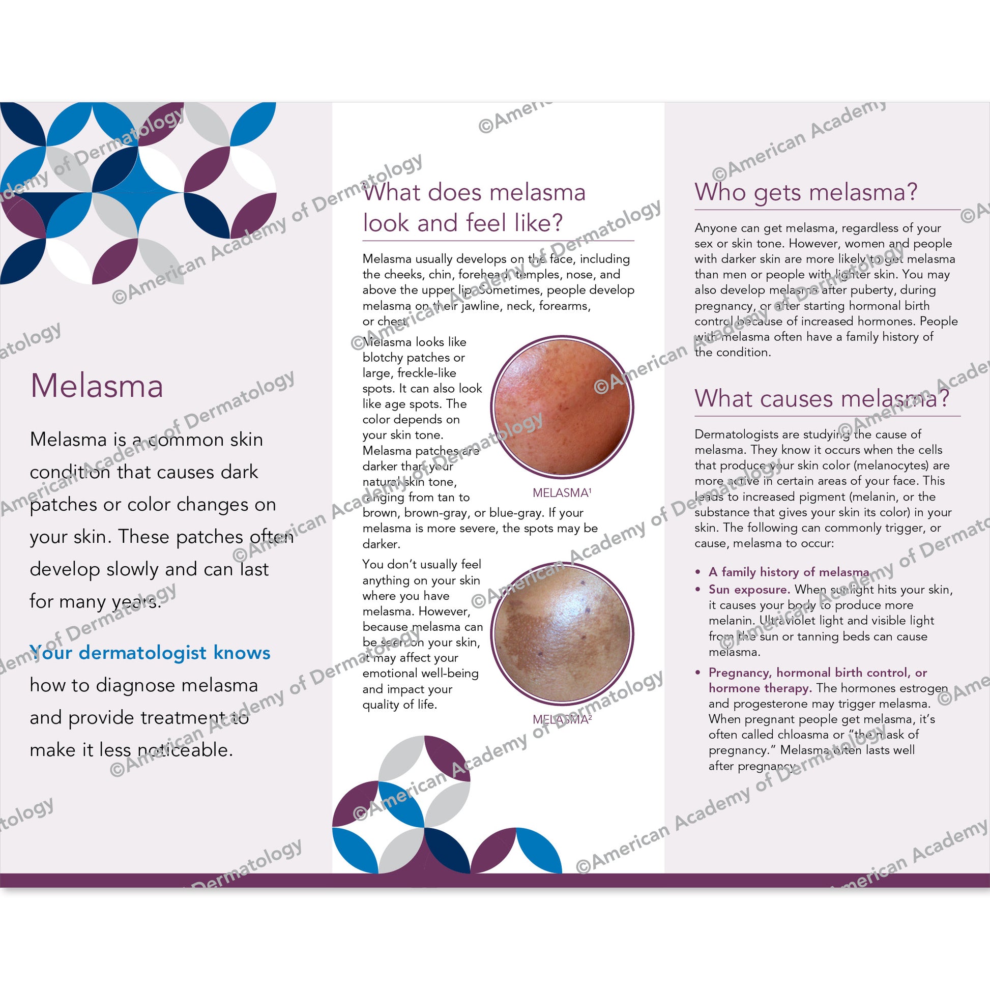 Melasma Pamphlet