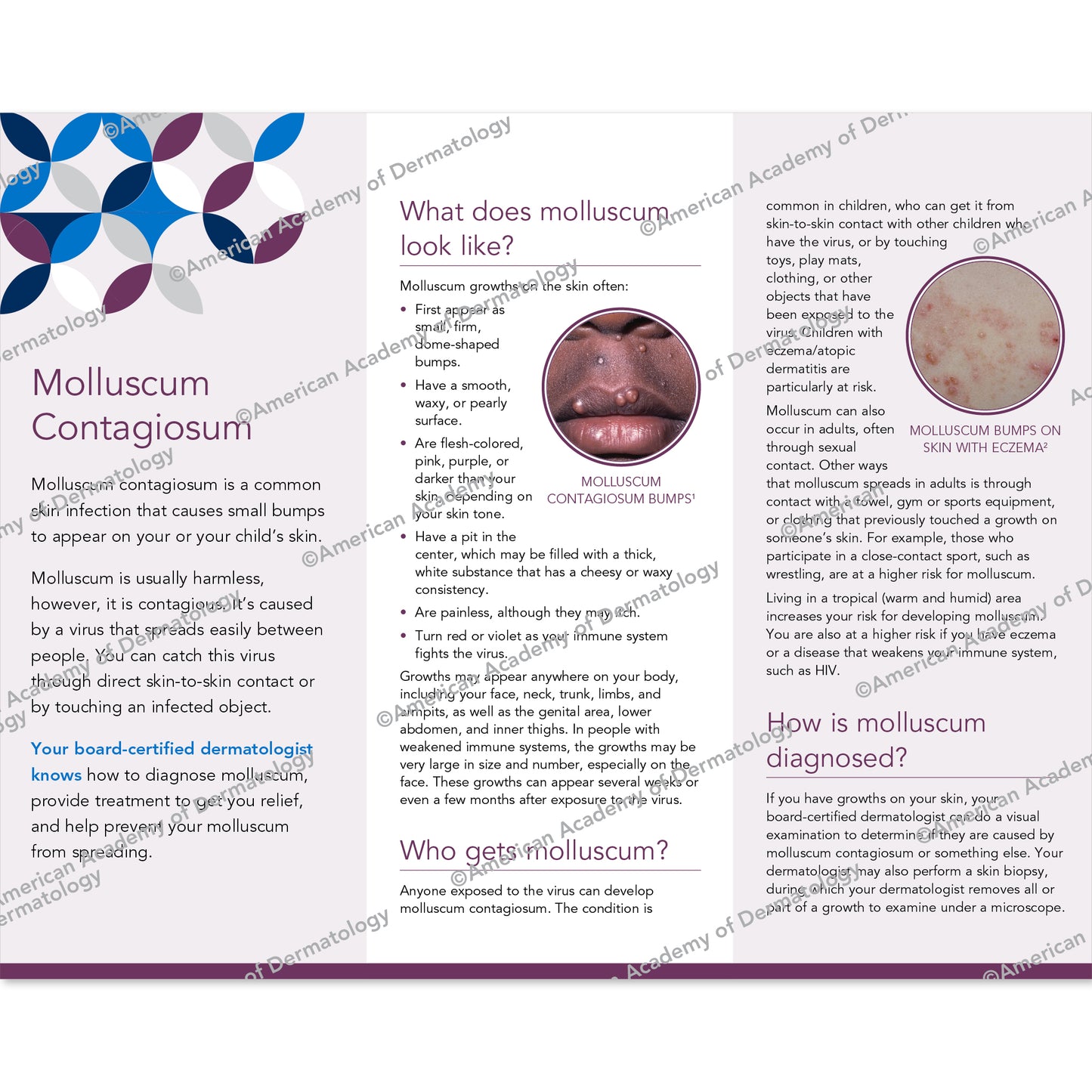 Molluscum Contagiosum Pamphlet
