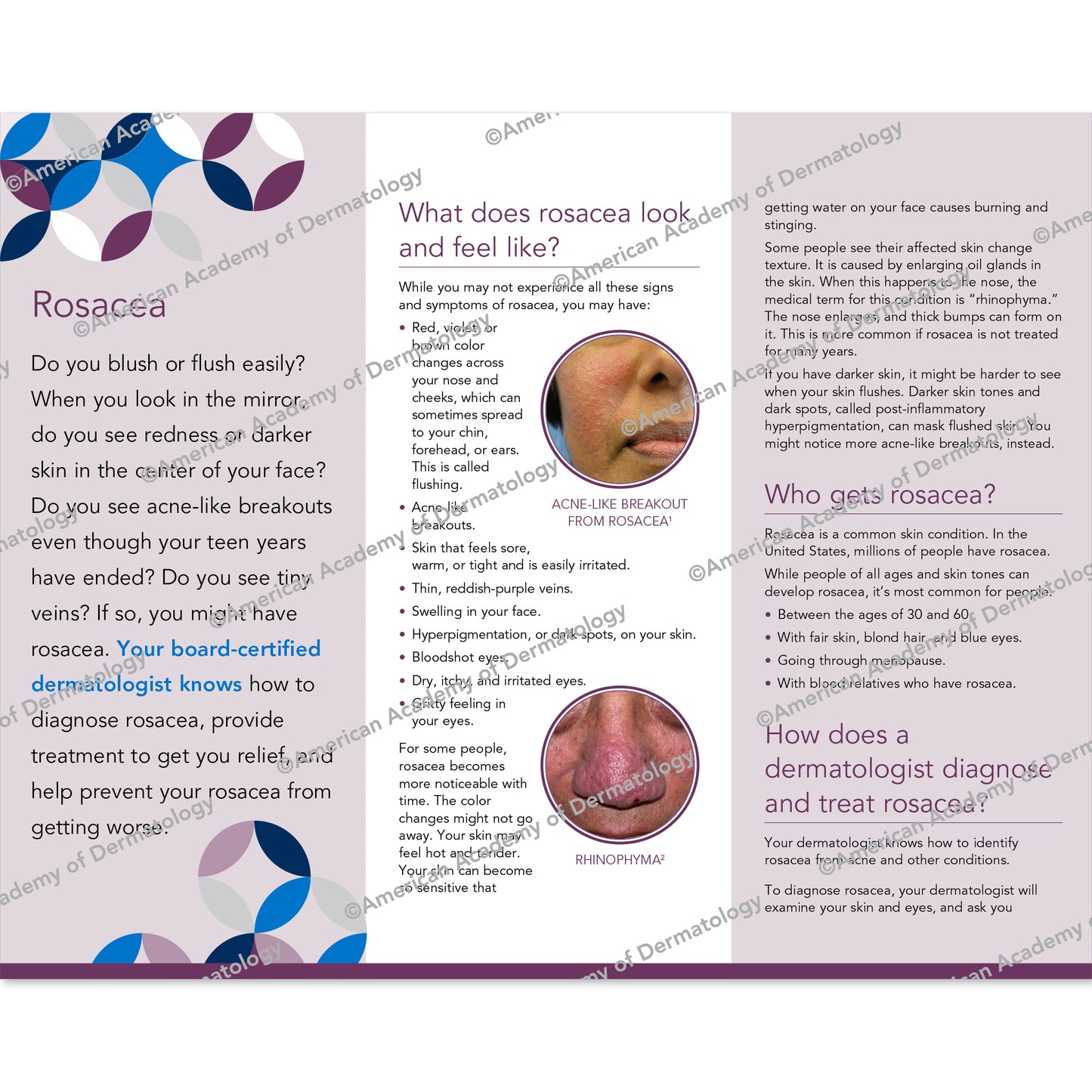 Rosacea Pamphlet