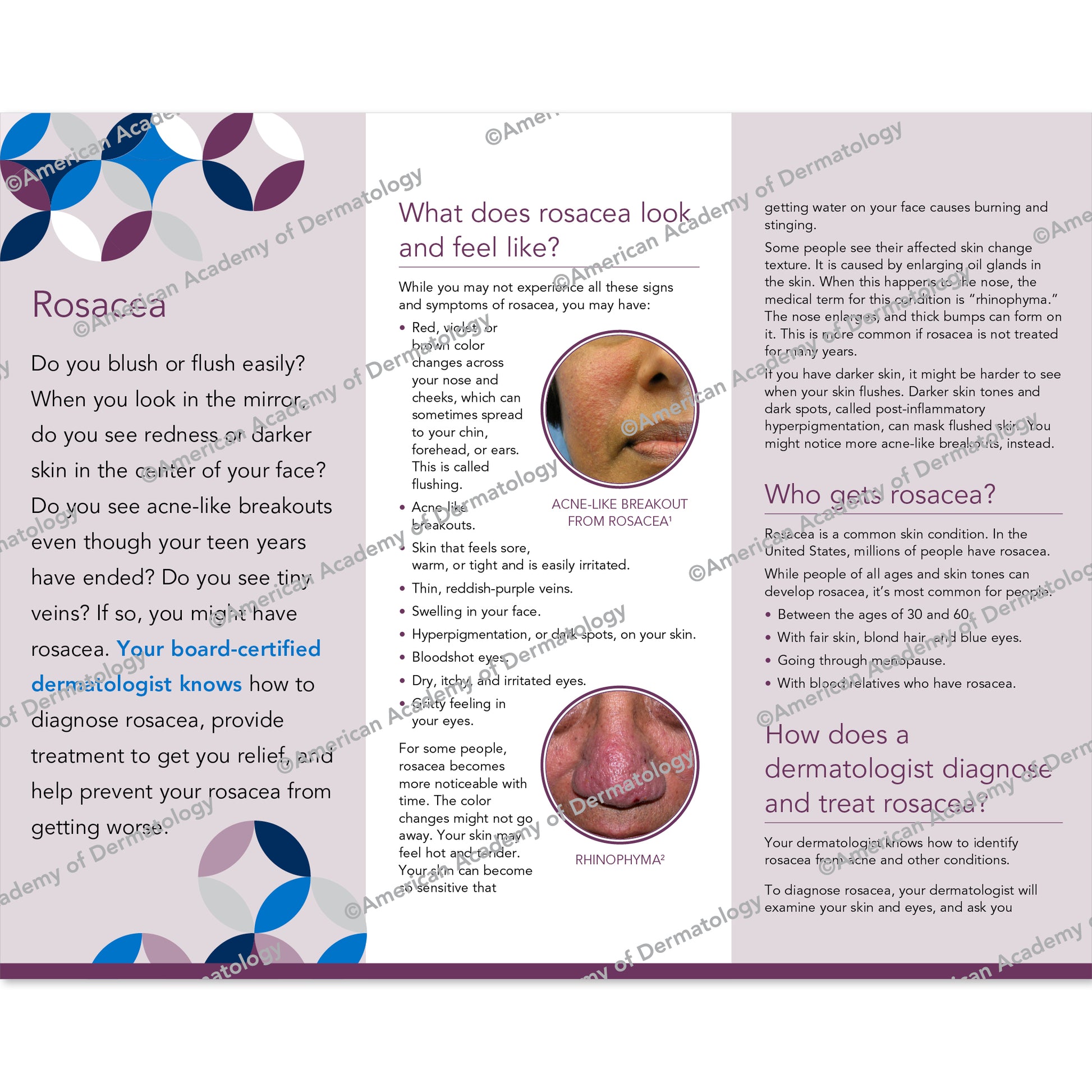 Rosacea Pamphlet