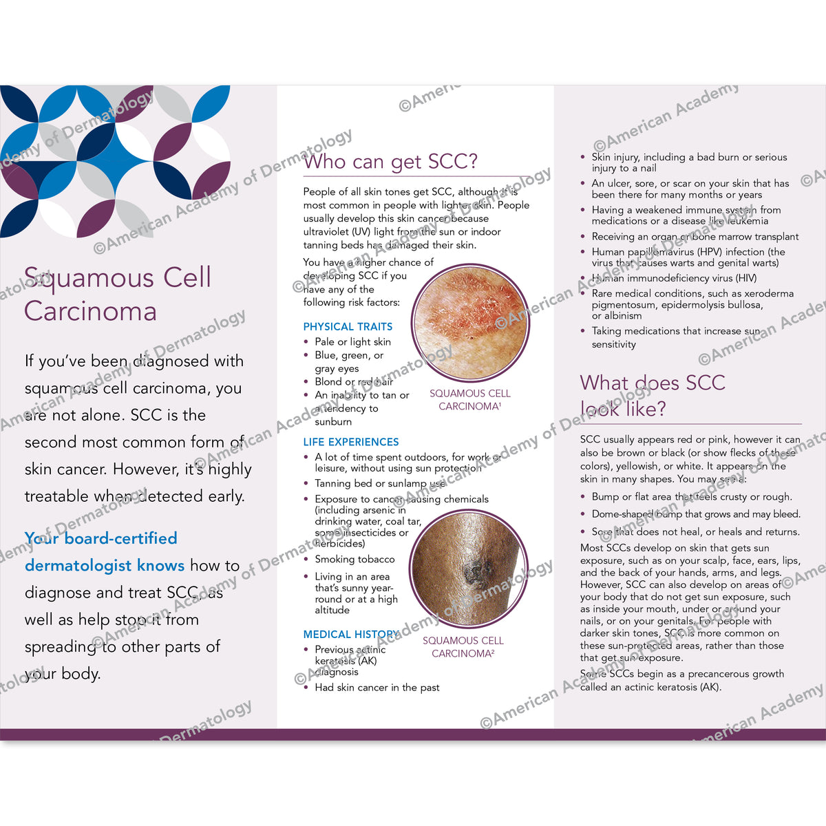 Squamous Cell Carcinoma