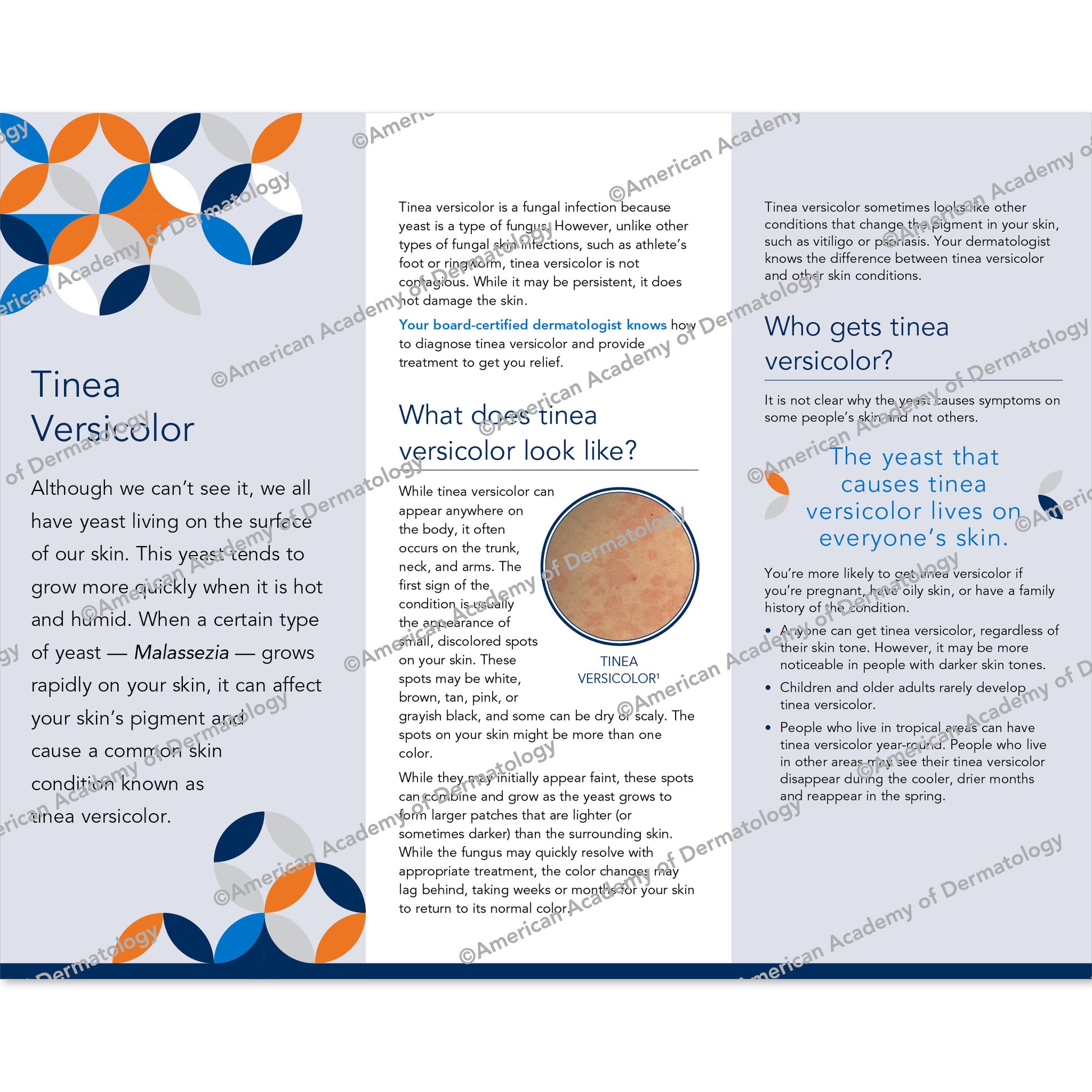 Tinea Versicolor Pamphlet