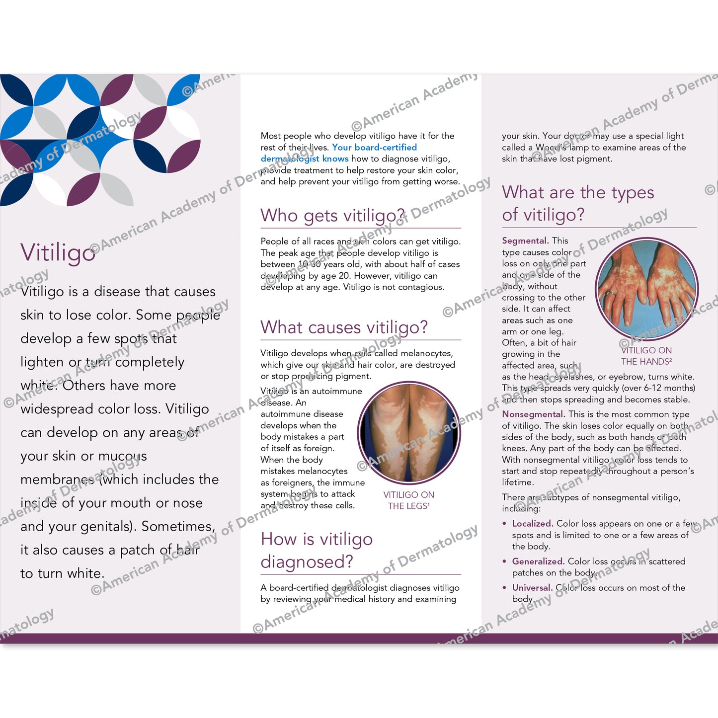 Vitiligo Pamphlet