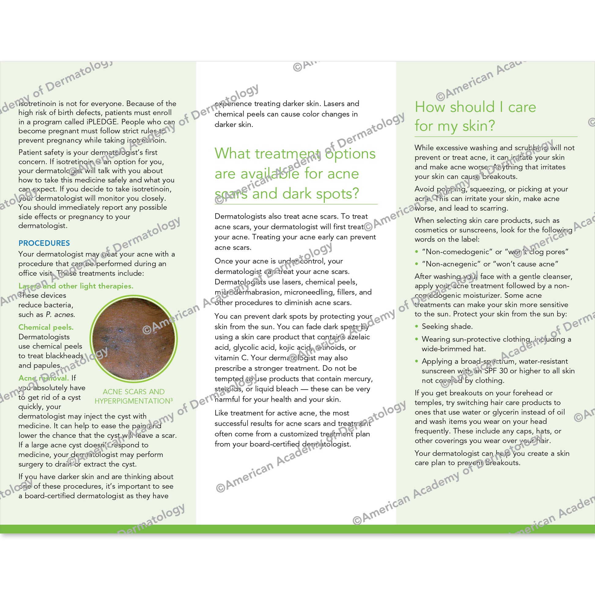 Acne Pamphlet