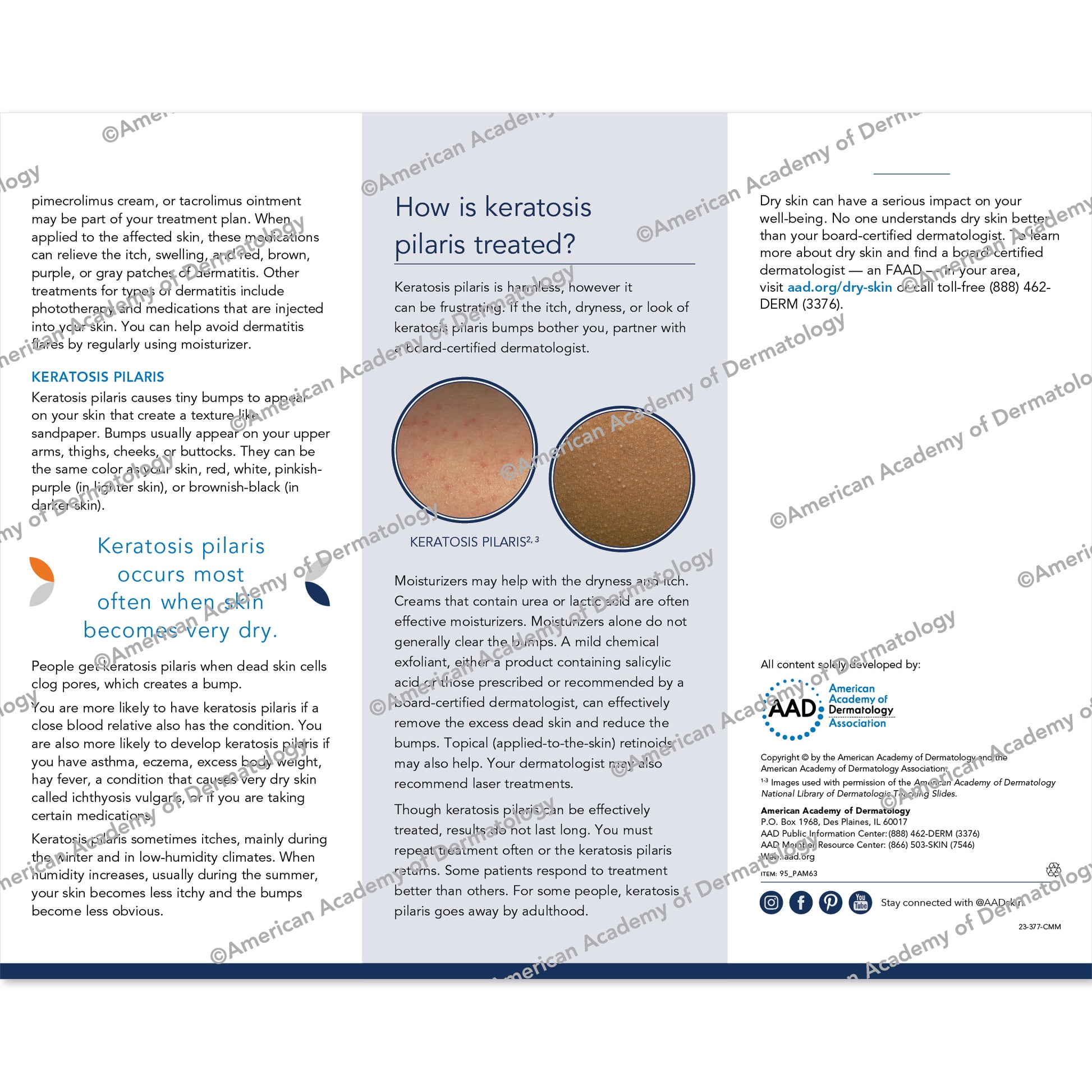 Dry Skin and Keratosis Pilaris Pamphlet