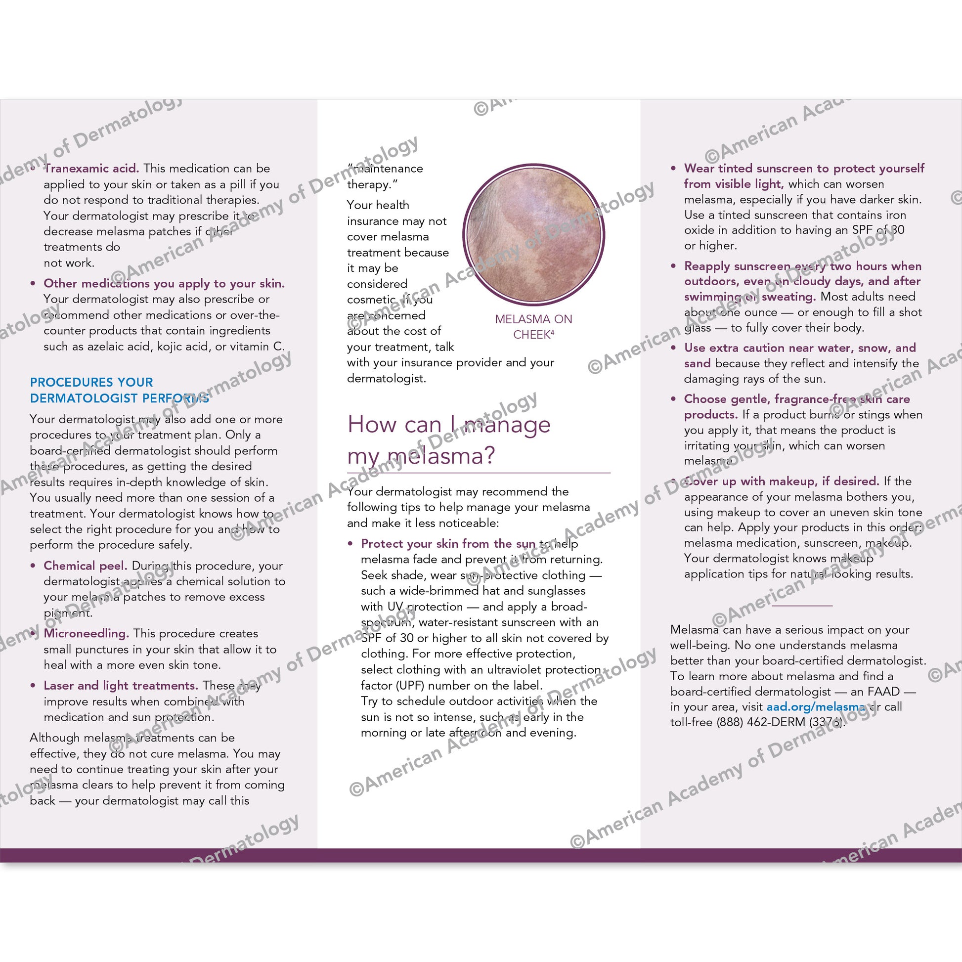 Melasma Pamphlet