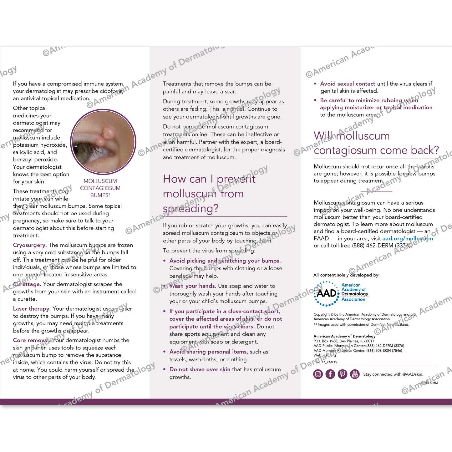 Molluscum Contagiosum Pamphlet