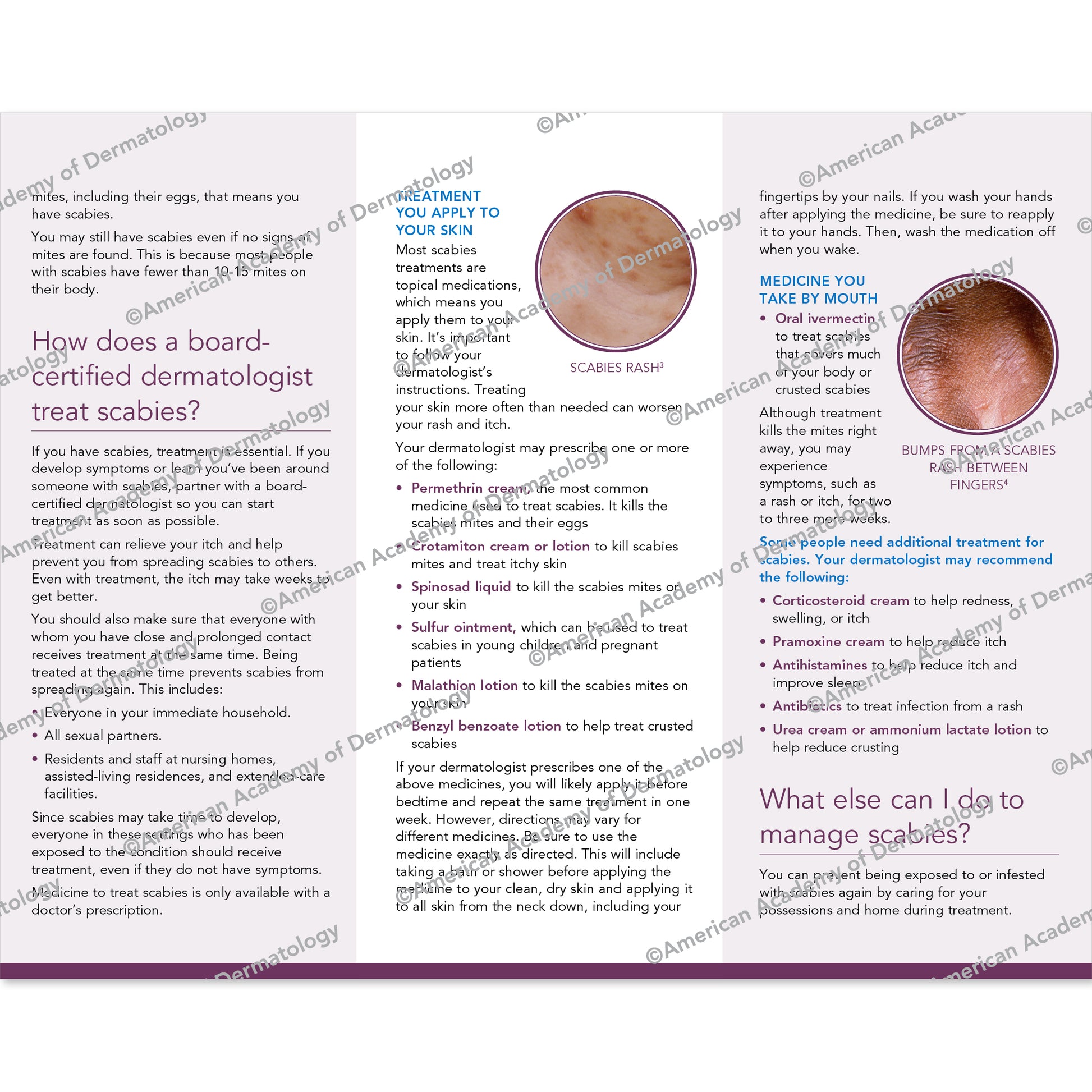 Scabies Pamphlet