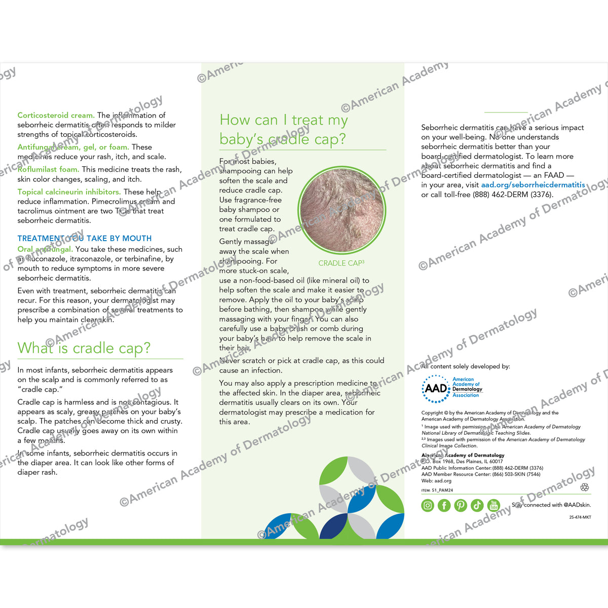 Seborrheic Dermatitis 