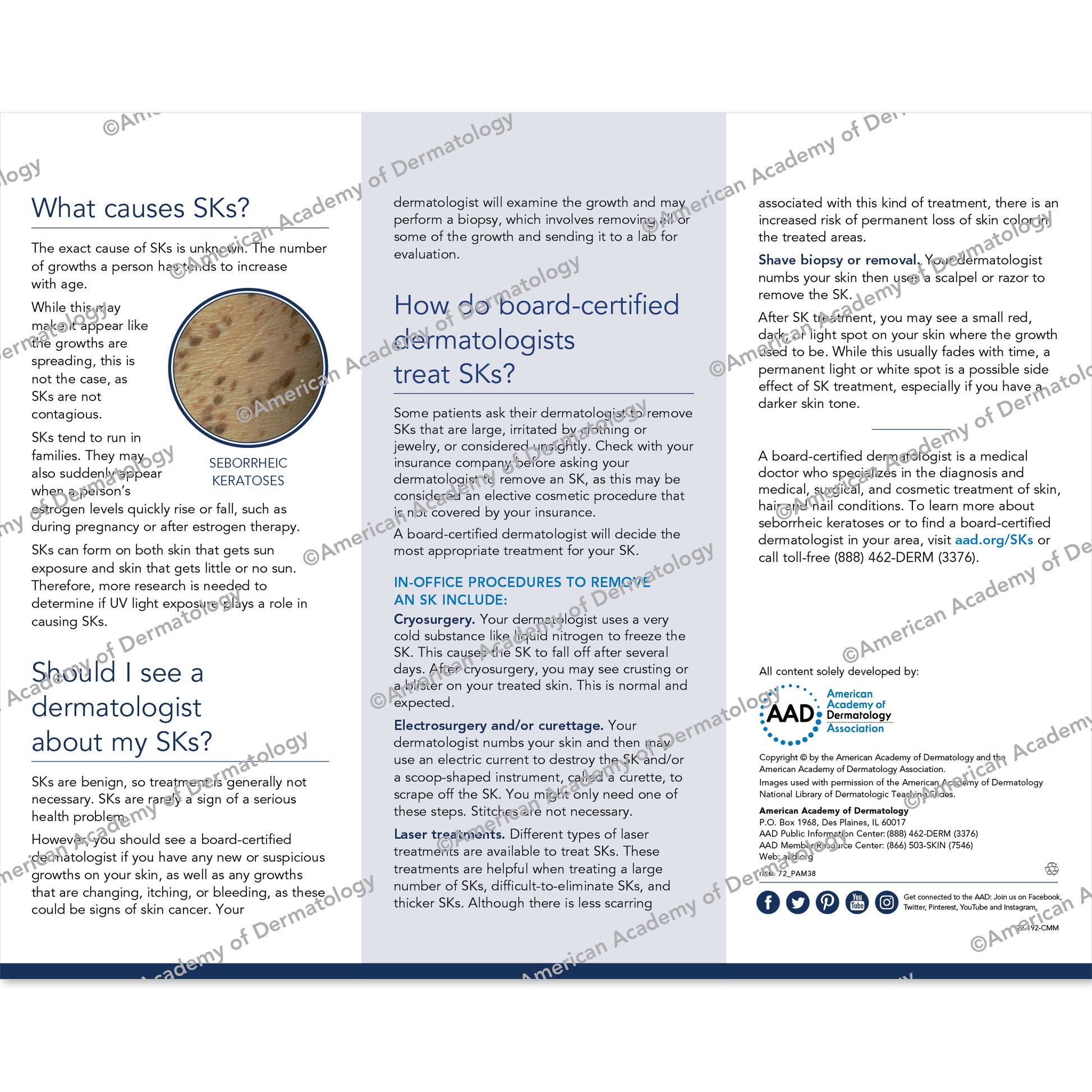 Seborrheic Keratoses Pamphlet