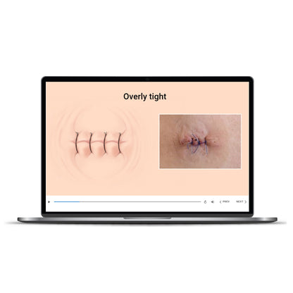 AAD Hands-on at Home Dermatology Suture Techniques